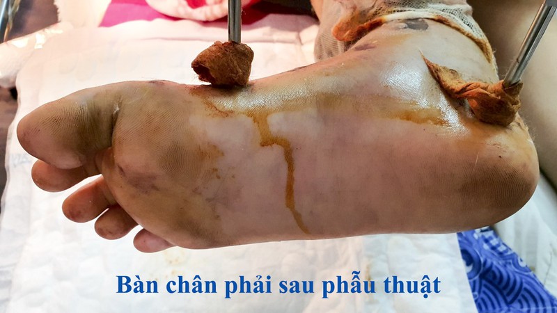  kich hoat co che "bao dong do" lien vien, cuu song be gai 15 tuoi hinh 1