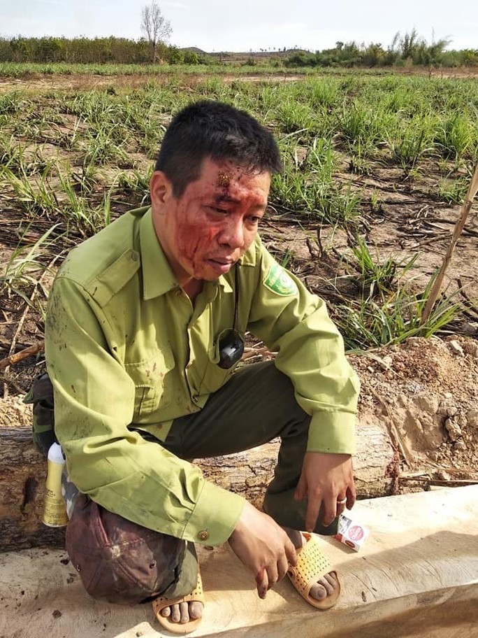 Lâm tặc manh động, vây đánh kiểm lâm toác đầu - Ảnh 1.