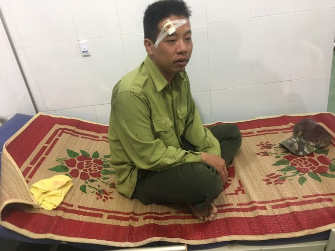 Lâm tặc manh động, vây đánh kiểm lâm toác đầu - Ảnh 3.