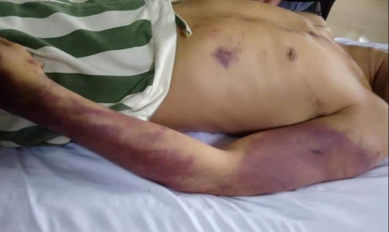 nong 24h: de nghi kiem soat dot xuat nha tam giu ca huyen chau duc hinh 1