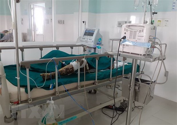 dieu tra vu do xang, cham lua dot khien 2 nguoi chet hinh 1
