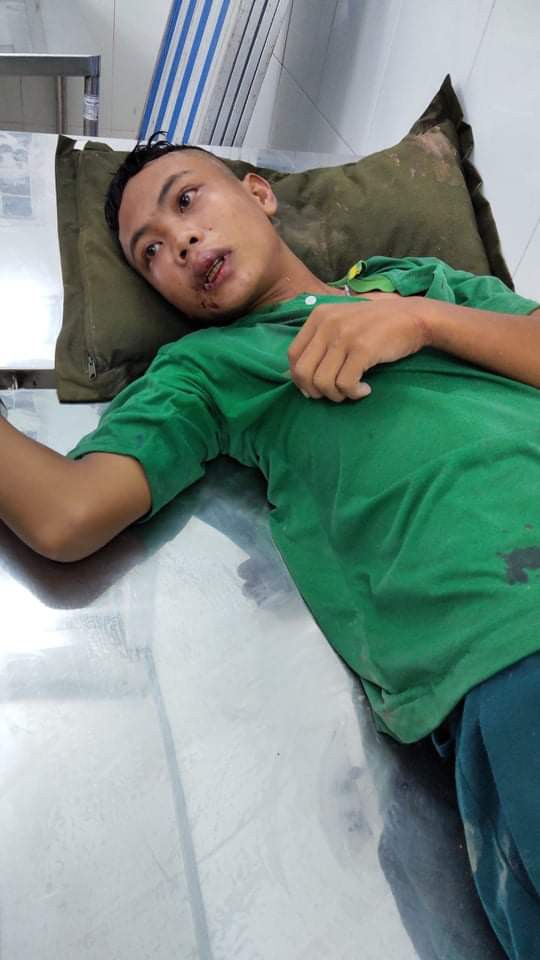 ​xu ly nghiem nhom buon lau tan cong luc luong chuc nang o kien giang hinh 1