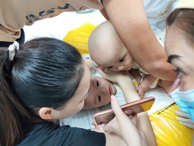 anh: hai be gai song sinh dinh lien vao phong phau thuat hinh 10
