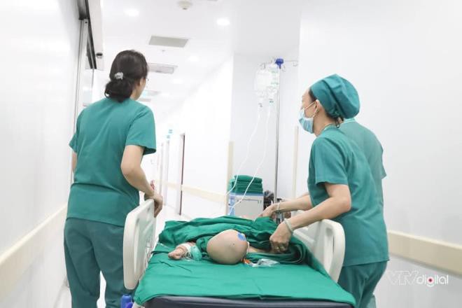 anh: hai be gai song sinh dinh lien vao phong phau thuat hinh 3