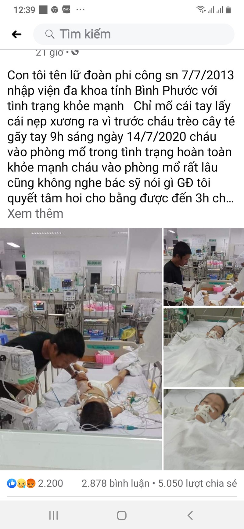 be trai 7 tuoi hon me sau sau phau thuat lay dinh nep xuong tay hinh 1