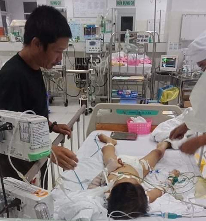 be trai 7 tuoi hon me sau sau phau thuat lay dinh nep xuong tay hinh 2