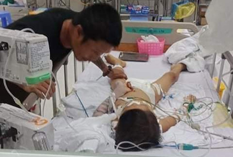 be 7 tuoi o binh phuoc da tu vong sau ca mo lay dinh nep xuong tay hinh 1