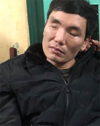 ke chem chet cu ong di tham mo bi khoi to hinh 1