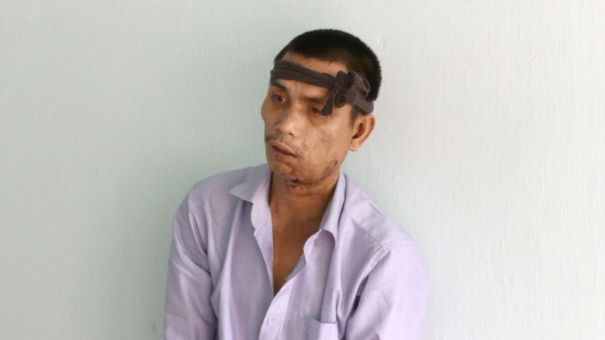 ban nguoi tinh bang sung ak roi tu sat vi mau thuan hinh 1