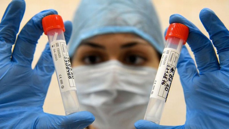 nga se san xuat vaccine ngua covid-19 vao thang 11 hinh 1
