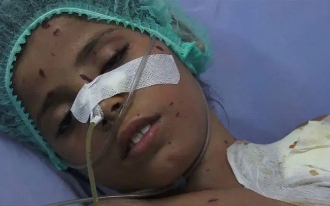 khoi phuc chuyen bay nhan dao cho benh nhan yemen roi vung chien su hinh 1