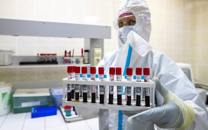vaccine "than toc"- nga quyet tam dua nhan loai thoat khoi covid-19 hinh 1