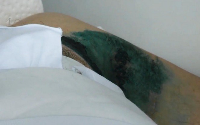chuyen bi set danh hai hung cua 3 nguoi nga hinh 2