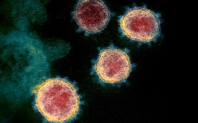 chung virus sars-cov-2 gay covid-19 tai australia la loai de lay nhiem hinh 1