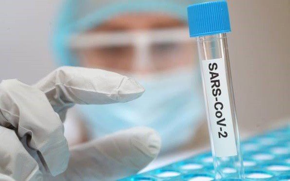 dieu che vaccine ngua covid-19 gap kho khan khi so ca mac benh giam hinh 1