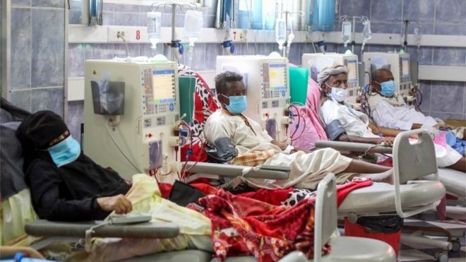 so ca tu vong do covid-19 o yemen chiem 25% so ca mac benh hinh 1