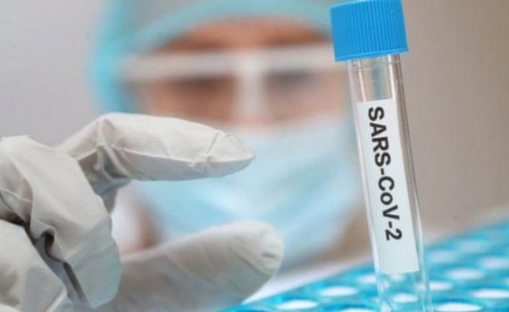 cac nuoc tang toc chay dua tim kiem vaccine covid-19 hinh 1