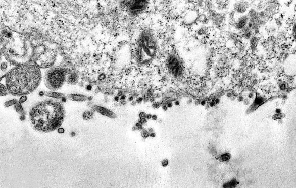 phat hien 3 bien chung cua virus sars-cov-2 tren the gioi hinh 1