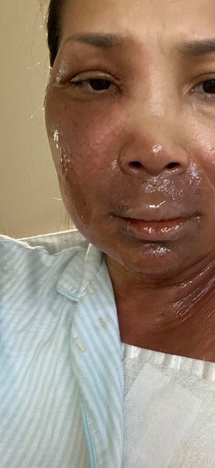 hong ngoc lan dau dang anh truc dien bi bong sau su co no noi xong hoi hinh 1
