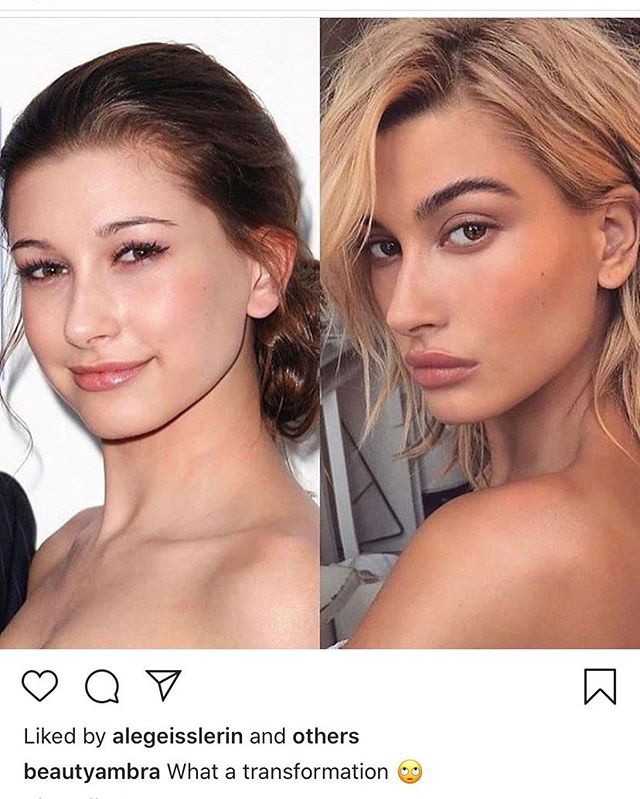 hailey baldwin gay bat ngo khi ke ve nu hon dau voi justin bieber hinh 2