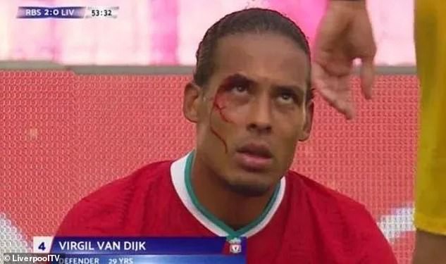 virgil van dijk do mau o tran dau voi rb salzburg hinh 1