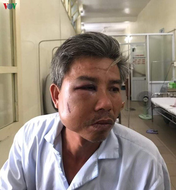 nong 24h: khang nghi giam doc tham vu bi cao nhay lau tu tu  hinh 7
